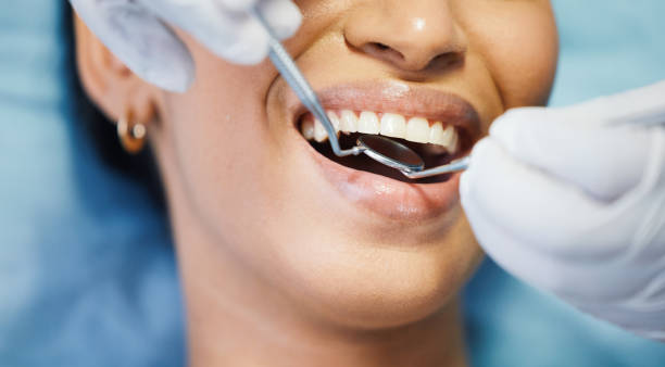 Best Broken Tooth Emergency  in Sweet Springs, MO