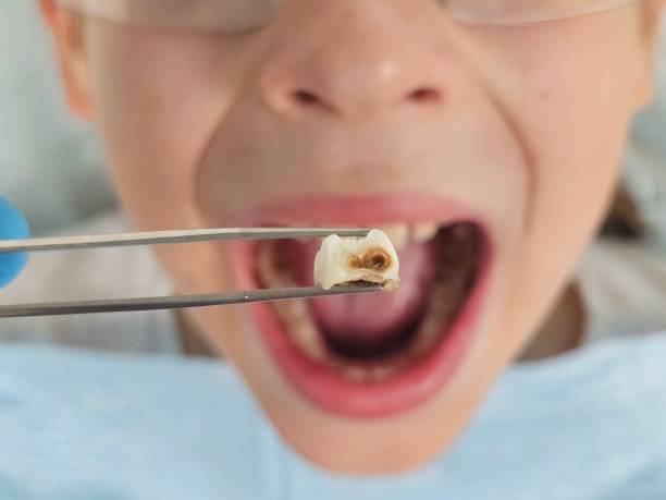 Best Tooth Pain Emergency Relief  in Sweet Springs, MO